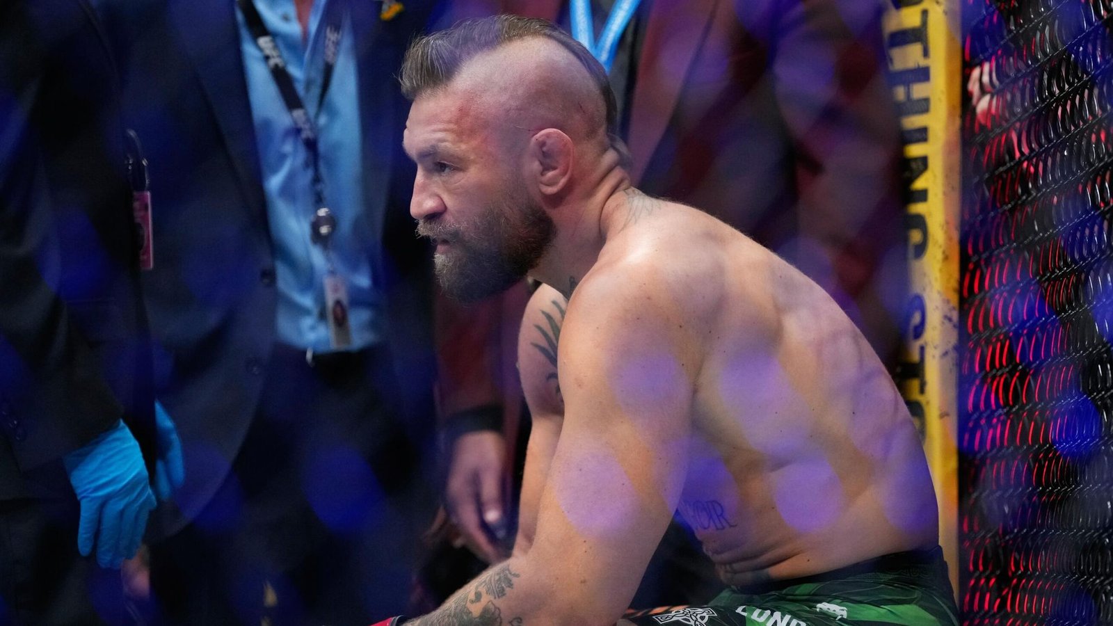 كونور ماكغريغور يغادر UFC 329 مترنحاً رافضاً العكازات.. ودانا وايت يكشف التشخيص المبدئي لإصابته